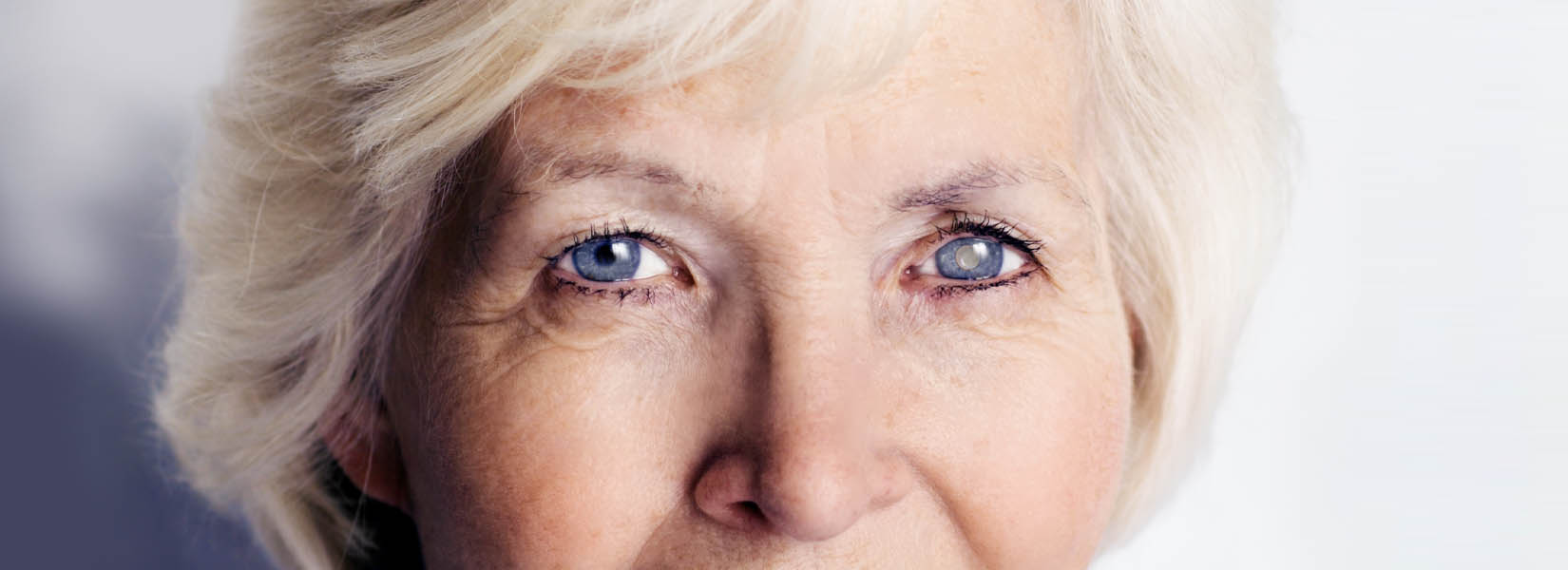 Cataract Surgery in Fredericksburg